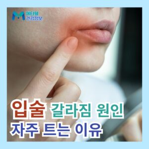 겨울철 몸 간지러움 가려움증 원인 해결법