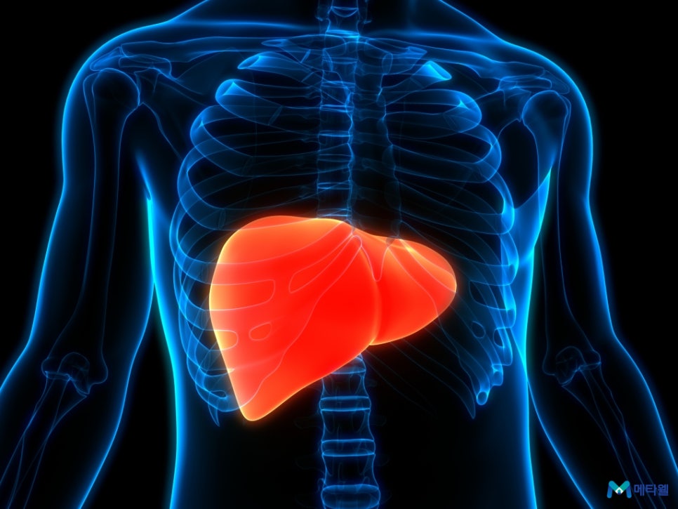 지방간 에 좋은 음식 식단 추천